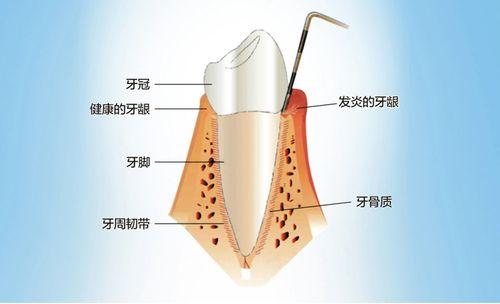 每月新闻!哈尔滨根管治疗哪家医院好点